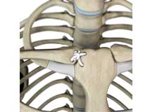 Sternoclavicular Joint Reconstruction